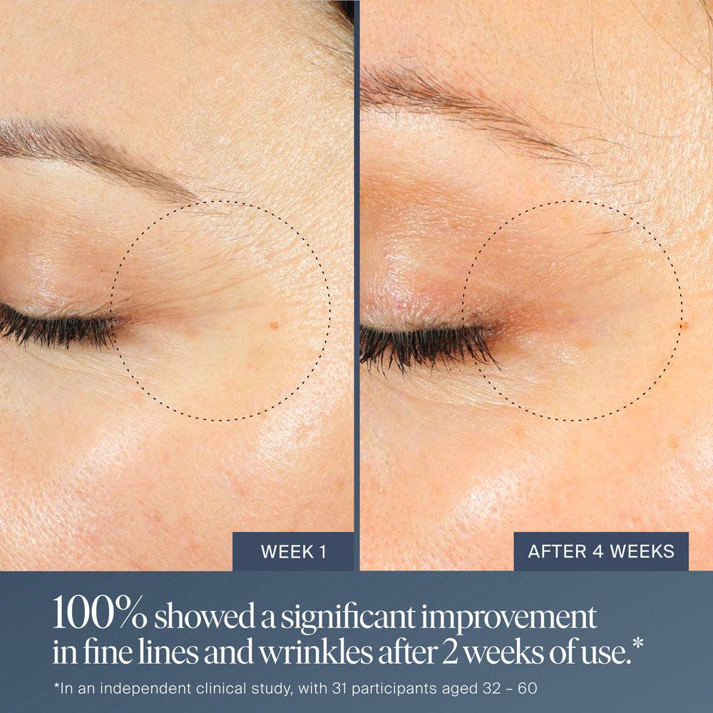 Jet Lag™ Overnight Eye Serum Summer Fridays