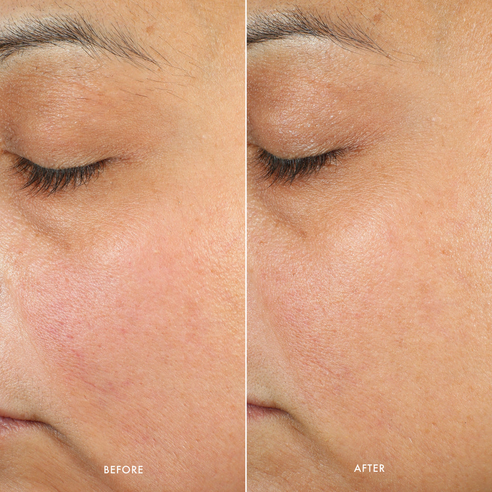Midnight Ritual Retinol Renewal Serum